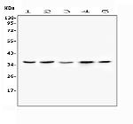 FRZB Polyclonal Antibody