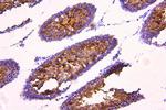 ACACB Polyclonal Antibody