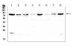 POMT2 Polyclonal Antibody