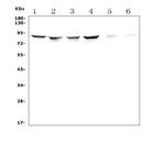 ALDH18A1 Polyclonal Antibody