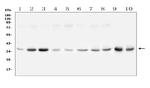 GPD1L Polyclonal Antibody