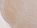 LMTK3 Polyclonal Antibody