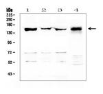LMTK3 Antibody in Western Blot (WB)