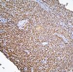 PHF21A Antibody in Immunohistochemistry (Paraffin) (IHC (P))