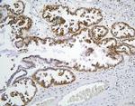 PHF21A Antibody in Immunohistochemistry (Paraffin) (IHC (P))