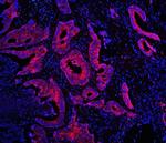 TDRD3 Antibody in Immunohistochemistry (Paraffin) (IHC (P))