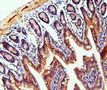 TDRD3 Polyclonal Antibody