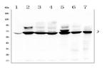 TDRD3 Antibody in Western Blot (WB)