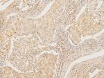 ATP5G1/2/3 Antibody in Immunohistochemistry (Paraffin) (IHC (P))