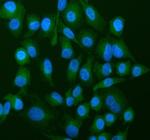 ATP5G1/2/3 Polyclonal Antibody