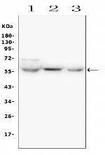SLC2A6 Polyclonal Antibody