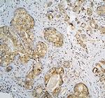 CPAMD8 Polyclonal Antibody