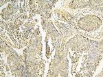 CPAMD8 Antibody in Immunohistochemistry (Paraffin) (IHC (P))