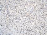 CCDC36 Antibody in Immunohistochemistry (Paraffin) (IHC (P))