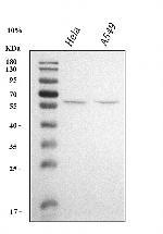 KLF5 Polyclonal Antibody