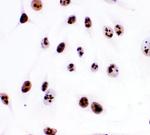 Ki67 Antibody in Immunocytochemistry (ICC/IF)
