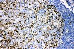 Ki67 Antibody in Immunohistochemistry (Paraffin) (IHC (P))