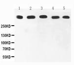 Ki67 Antibody in Western Blot (WB)