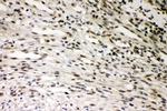SMURF1 Antibody in Immunohistochemistry (Paraffin) (IHC (P))