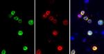 SARS-CoV-2 Spike Protein S1 Antibody in Immunohistochemistry (Paraffin) (IHC (P))