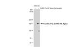 SARS-CoV-2 Spike Protein S1 Antibody in Western Blot (WB)