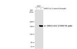 SARS-CoV-2 Spike Protein S1 Antibody in Western Blot (WB)