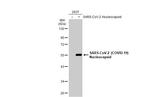 SARS-CoV-2 Nucleocapsid Antibody in Western Blot (WB)