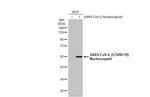 SARS-CoV-2 Nucleocapsid Antibody in Western Blot (WB)