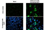 SARS-CoV-2 Nucleocapsid Antibody in Immunocytochemistry (ICC/IF)