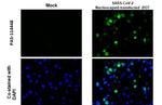 SARS-CoV-2 Nucleocapsid Antibody in Immunocytochemistry (ICC/IF)