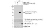 SARS-CoV-2 Nucleocapsid Antibody in Western Blot (WB)