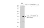 SARS-CoV-2 Nucleocapsid Antibody in Western Blot (WB)