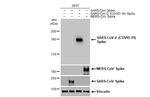 SARS-CoV-2 Spike Protein (RBD) Antibody in Western Blot (WB)