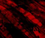 Emerin Polyclonal Antibody