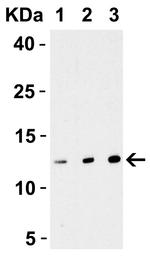 Strep Tag Polyclonal Antibody