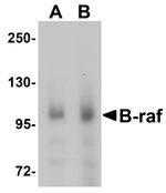 B-Raf Polyclonal Antibody