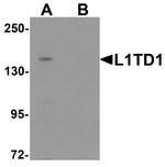 L1TD1 Polyclonal Antibody