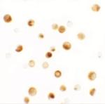 LAP2 Polyclonal Antibody