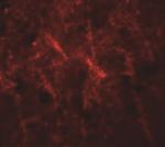 SIPA1 Polyclonal Antibody