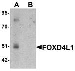 FOXD4L1 Antibody in Western Blot (WB)