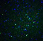 APOE Polyclonal Antibody