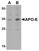 APOE Antibody in Western Blot (WB)
