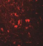 beta-2 Microglobulin Antibody in Immunohistochemistry (Paraffin) (IHC (P))