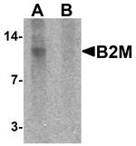 beta-2 Microglobulin Antibody in Western Blot (WB)