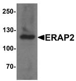 ERAP2 Polyclonal Antibody