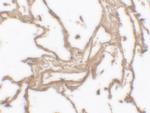 MMP9 Polyclonal Antibody