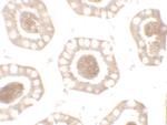 CD272 (BTLA) Polyclonal Antibody