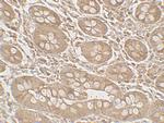 Mist1 Polyclonal Antibody