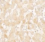 UCP1 Polyclonal Antibody