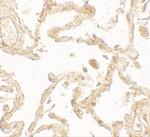 SUZ12 Polyclonal Antibody